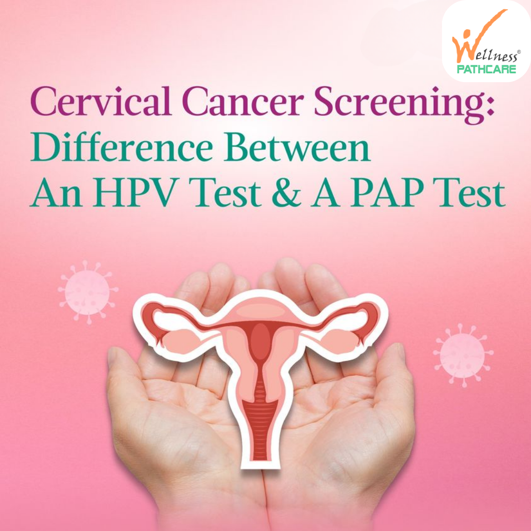 Cervical Cancer Screening